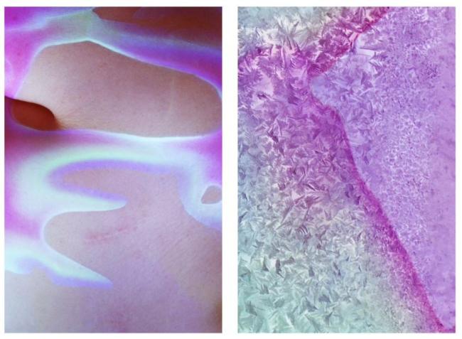 Sarah Seené, Corolles radicantes, 2023